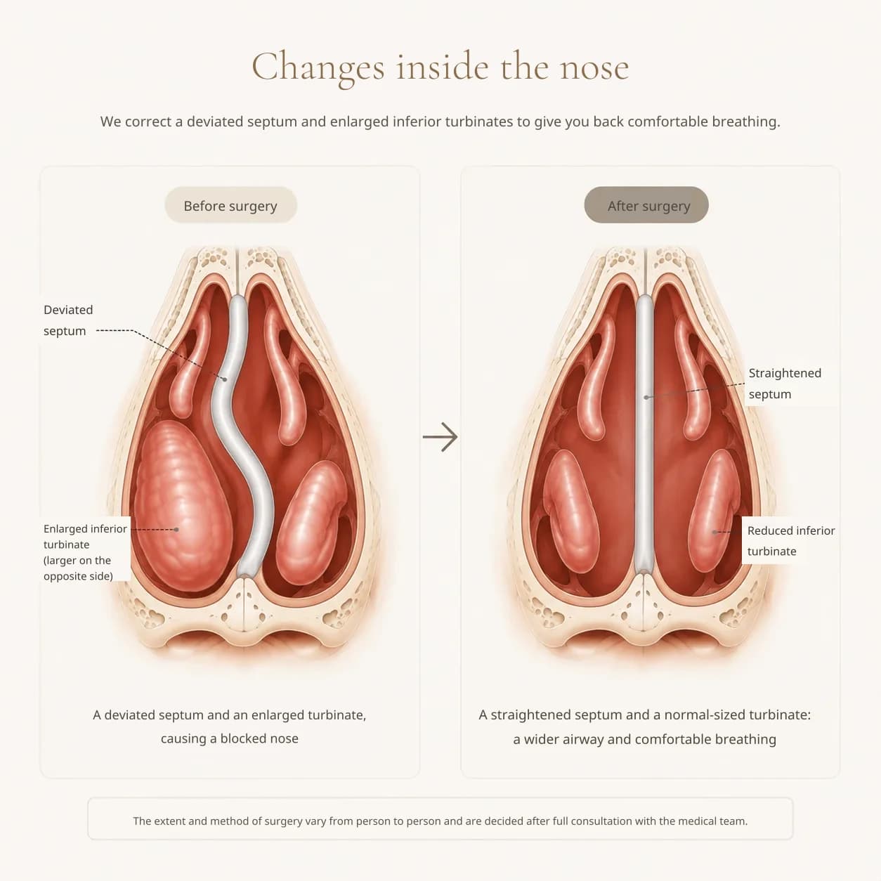 Diagram of the inner structure of the nose