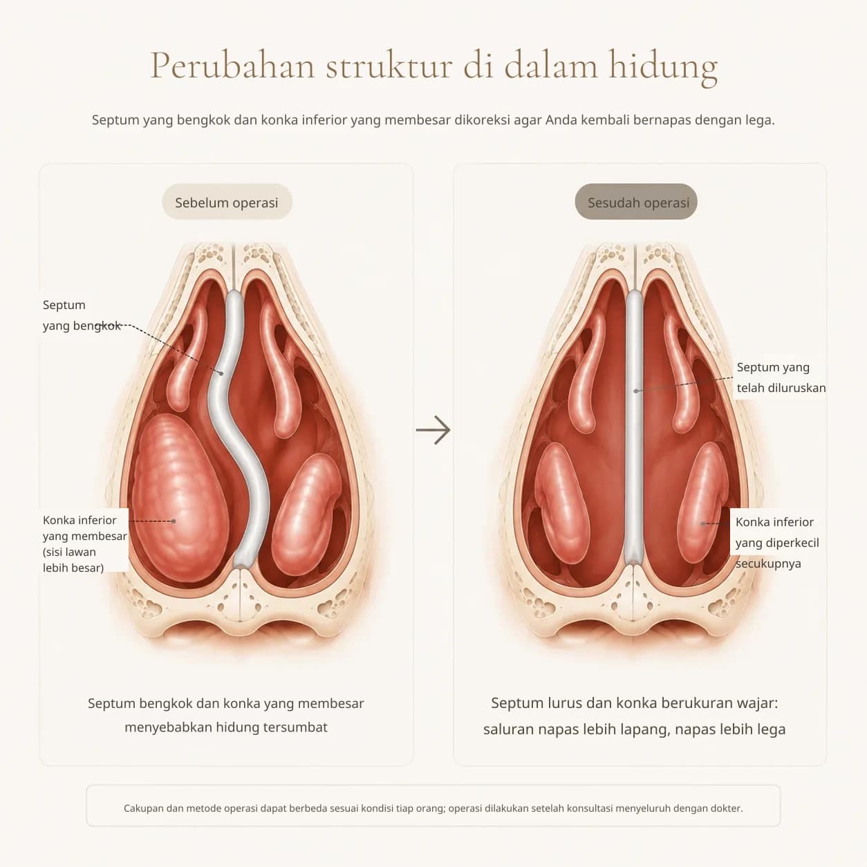 Diagram struktur bagian dalam hidung