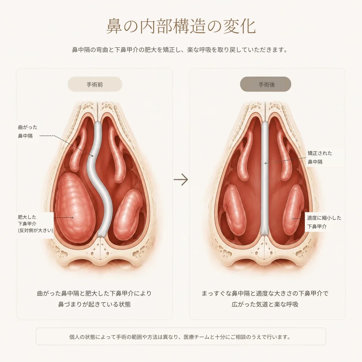 鼻の内部構造の図解