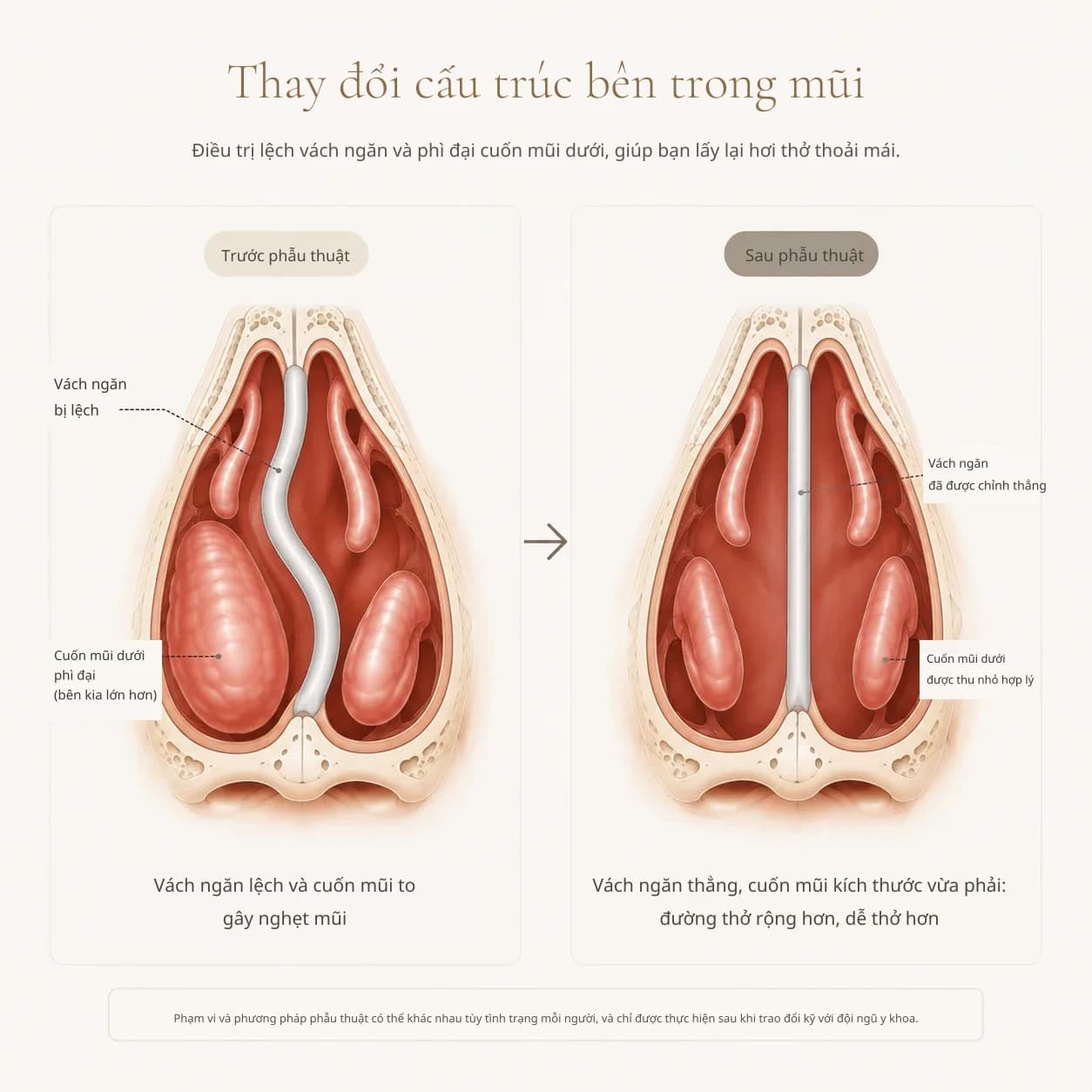 Sơ đồ cấu trúc bên trong mũi